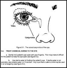 Eye Chemical Burning Treatment